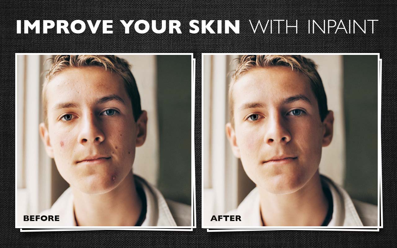 照片恢复软件示例-修饰皱纹，去除皮肤缺陷